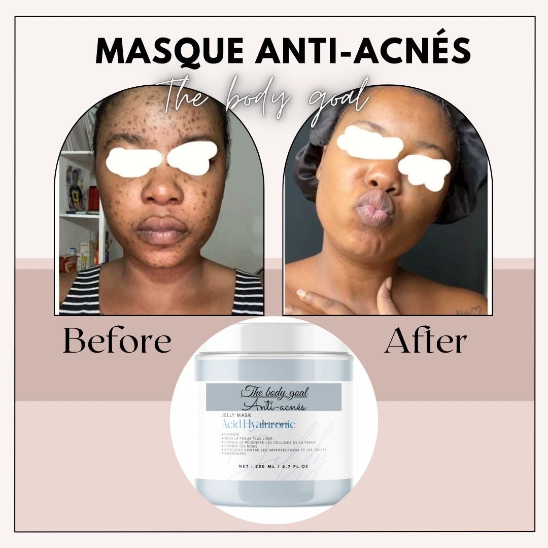 Masque anti-acnés et tâches